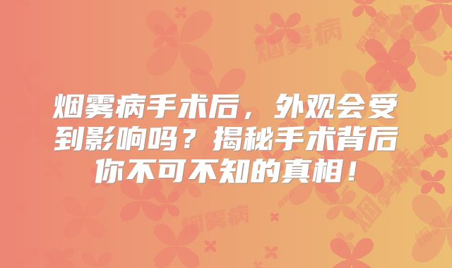 烟雾病手术后，外观会受到影响吗？揭秘手术背后你不可不知的真相！