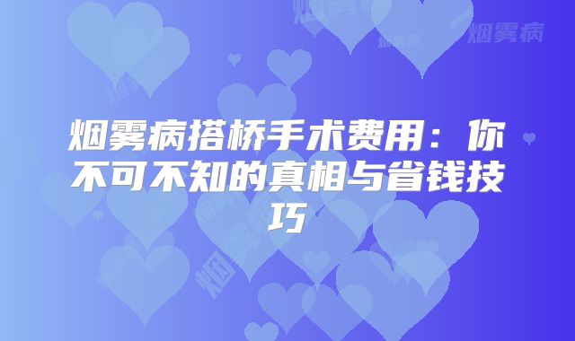 烟雾病搭桥手术费用：你不可不知的真相与省钱技巧
