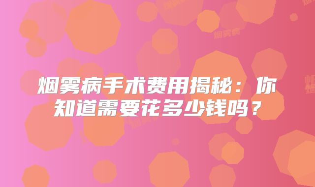 烟雾病手术费用揭秘：你知道需要花多少钱吗？