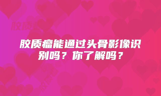 胶质瘤能通过头骨影像识别吗？你了解吗？