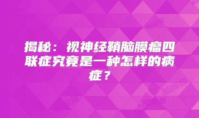揭秘：视神经鞘脑膜瘤四联症究竟是一种怎样的病症？