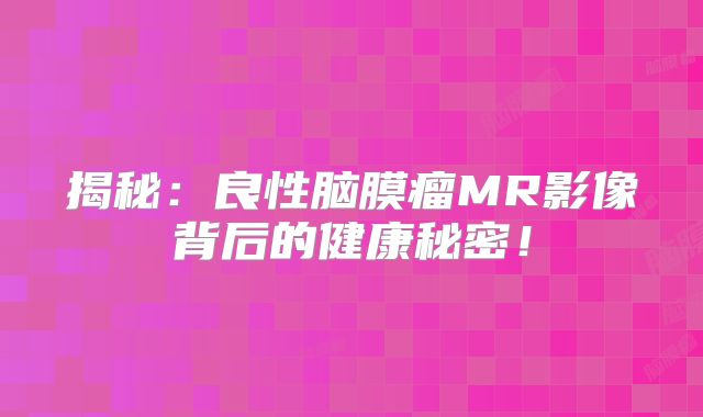 揭秘：良性脑膜瘤MR影像背后的健康秘密！