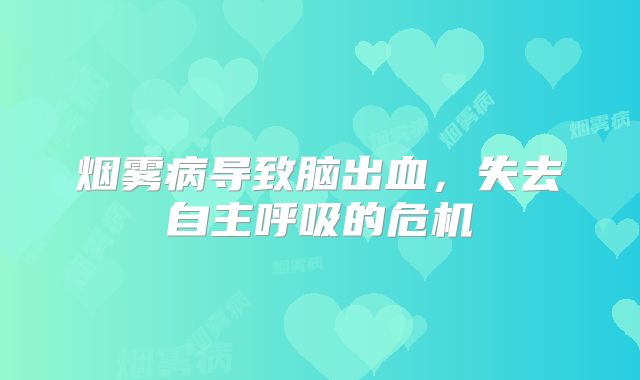 烟雾病导致脑出血，失去自主呼吸的危机
