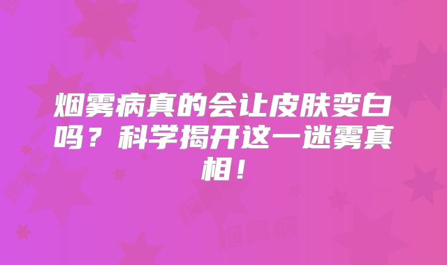 烟雾病真的会让皮肤变白吗？科学揭开这一迷雾真相！