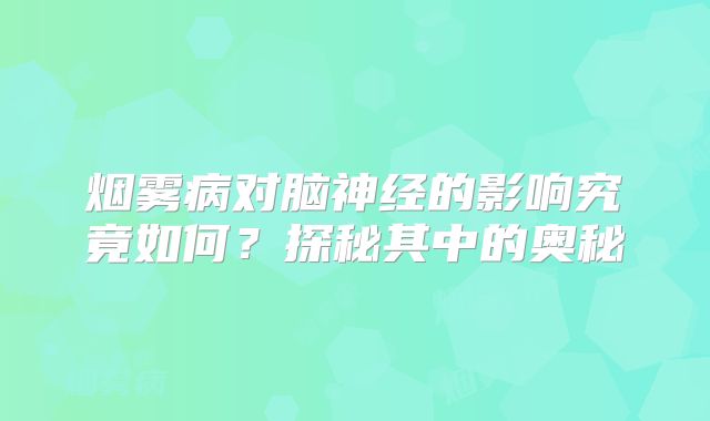 烟雾病对脑神经的影响究竟如何？探秘其中的奥秘