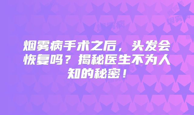 烟雾病手术之后，头发会恢复吗？揭秘医生不为人知的秘密！