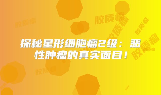 探秘星形细胞瘤2级：恶性肿瘤的真实面目！