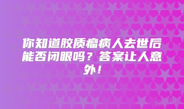 你知道胶质瘤病人去世后能否闭眼吗？答案让人意外！