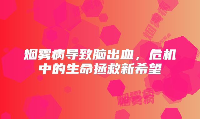 烟雾病导致脑出血，危机中的生命拯救新希望