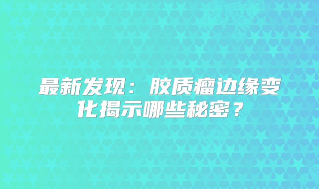 最新发现：胶质瘤边缘变化揭示哪些秘密？