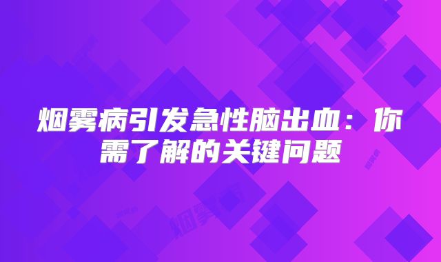 烟雾病引发急性脑出血：你需了解的关键问题