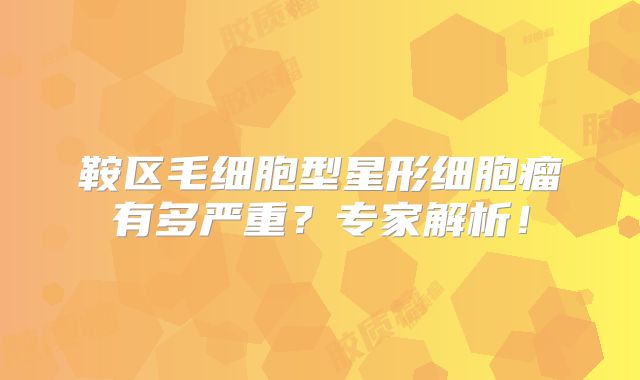 鞍区毛细胞型星形细胞瘤有多严重？专家解析！