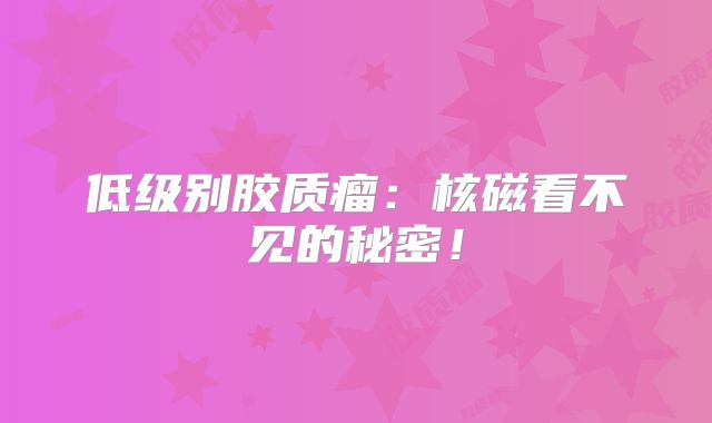 低级别胶质瘤：核磁看不见的秘密！