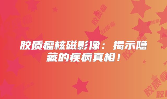 胶质瘤核磁影像：揭示隐藏的疾病真相！