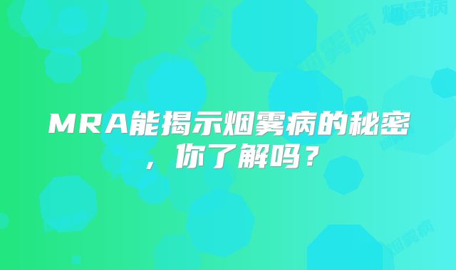MRA能揭示烟雾病的秘密，你了解吗？