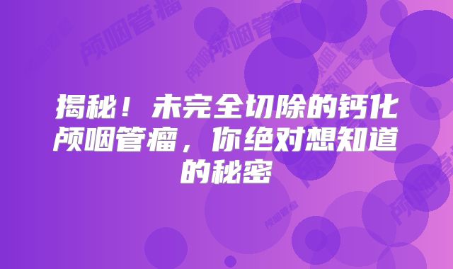 揭秘！未完全切除的钙化颅咽管瘤，你绝对想知道的秘密