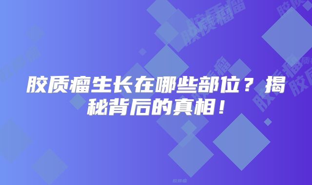 胶质瘤生长在哪些部位？揭秘背后的真相！