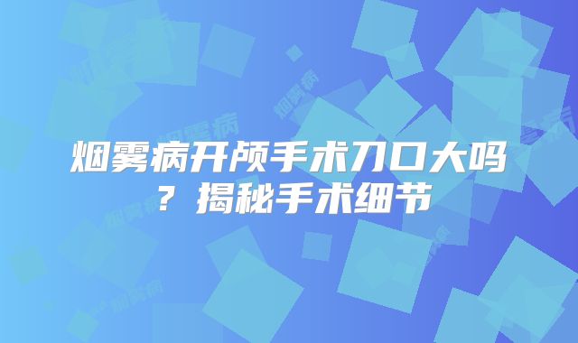 烟雾病开颅手术刀口大吗？揭秘手术细节