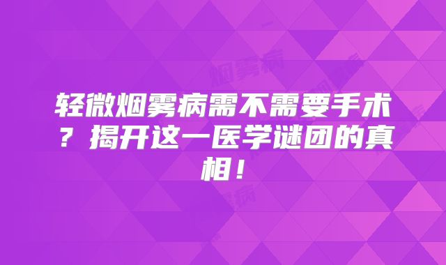 轻微烟雾病需不需要手术？揭开这一医学谜团的真相！