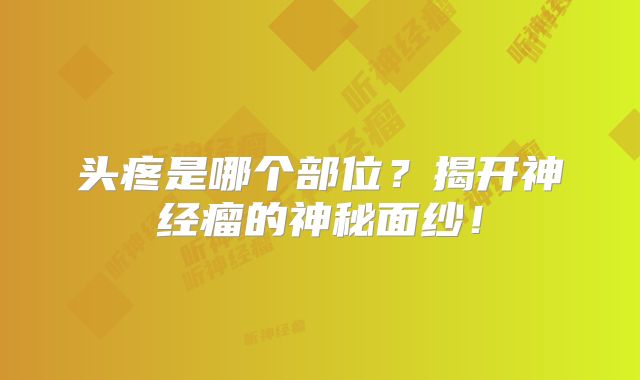 头疼是哪个部位？揭开神经瘤的神秘面纱！
