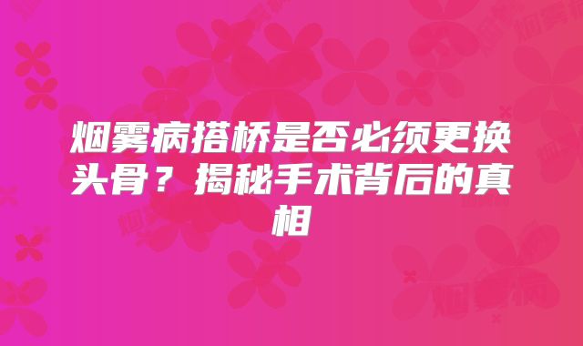 烟雾病搭桥是否必须更换头骨？揭秘手术背后的真相