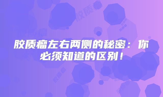 胶质瘤左右两侧的秘密：你必须知道的区别！