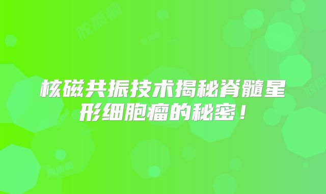 核磁共振技术揭秘脊髓星形细胞瘤的秘密！