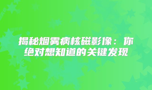 揭秘烟雾病核磁影像：你绝对想知道的关键发现