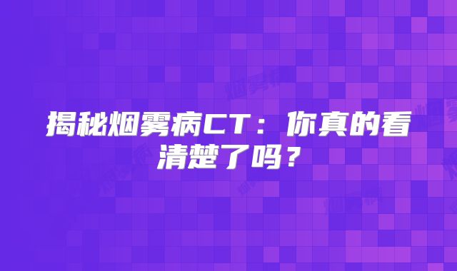 揭秘烟雾病CT：你真的看清楚了吗？