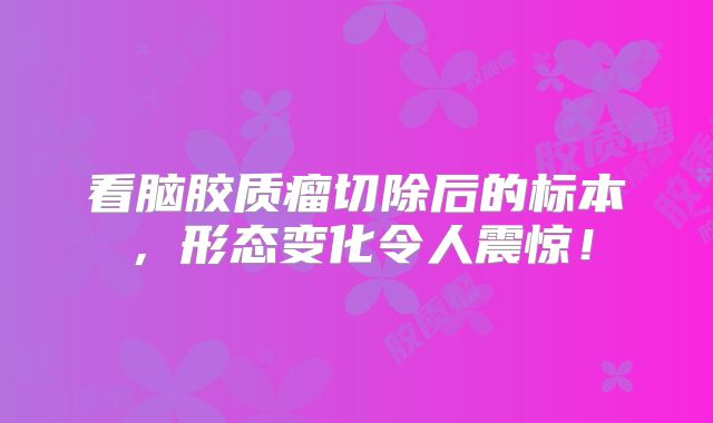 看脑胶质瘤切除后的标本，形态变化令人震惊！