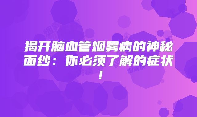揭开脑血管烟雾病的神秘面纱：你必须了解的症状！