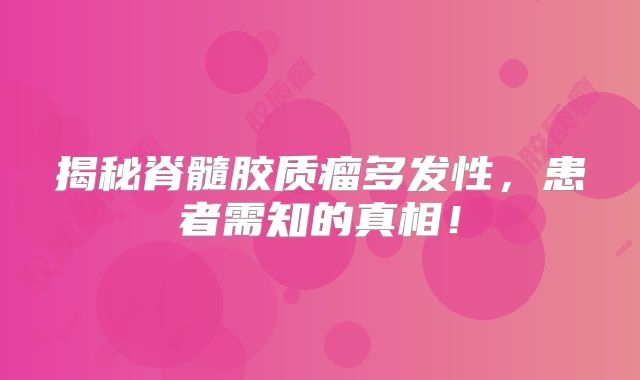 揭秘脊髓胶质瘤多发性，患者需知的真相！