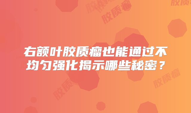 右额叶胶质瘤也能通过不均匀强化揭示哪些秘密？