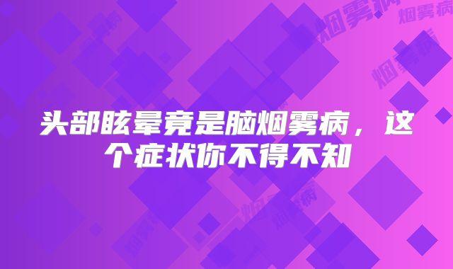 头部眩晕竟是脑烟雾病，这个症状你不得不知