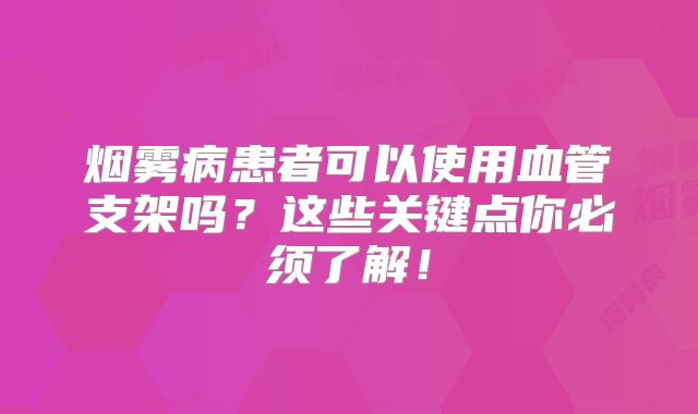 烟雾病患者可以使用血管支架吗？这些关键点你必须了解！