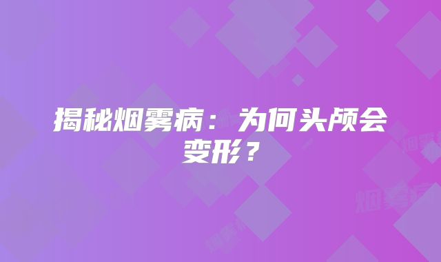 揭秘烟雾病：为何头颅会变形？