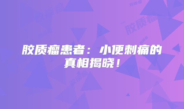 胶质瘤患者：小便刺痛的真相揭晓！