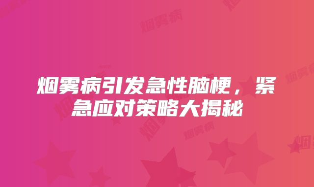 烟雾病引发急性脑梗，紧急应对策略大揭秘