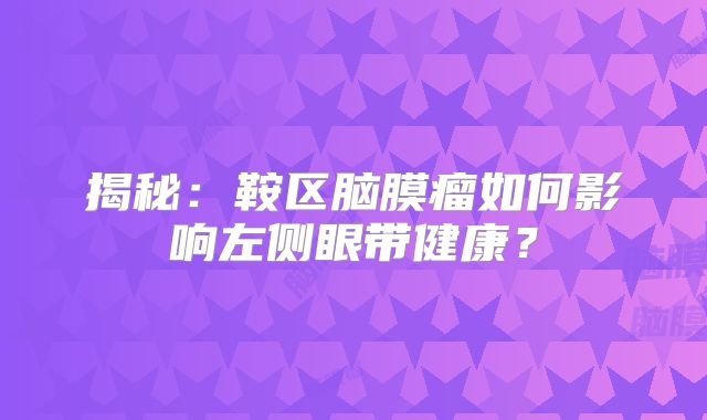 揭秘：鞍区脑膜瘤如何影响左侧眼带健康？