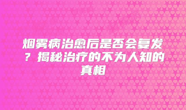 烟雾病治愈后是否会复发？揭秘治疗的不为人知的真相