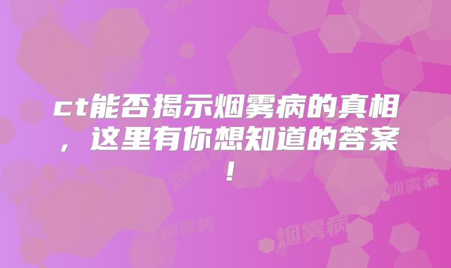 ct能否揭示烟雾病的真相，这里有你想知道的答案！