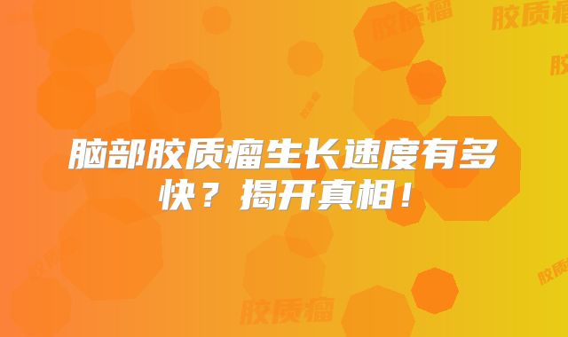 脑部胶质瘤生长速度有多快？揭开真相！