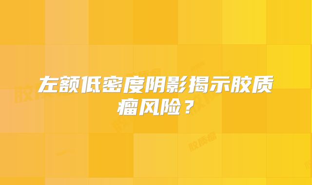 左额低密度阴影揭示胶质瘤风险？