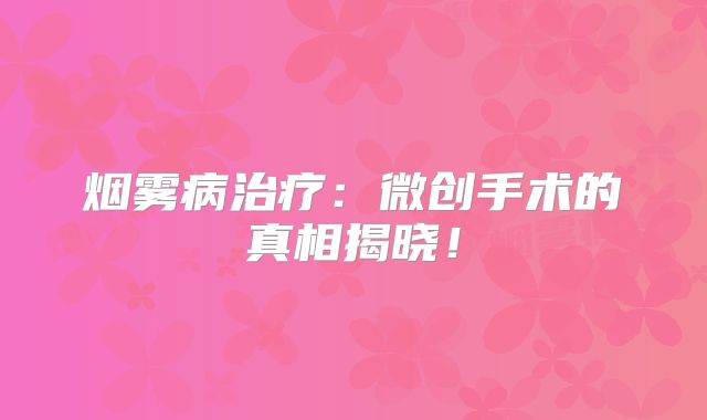 烟雾病治疗：微创手术的真相揭晓！