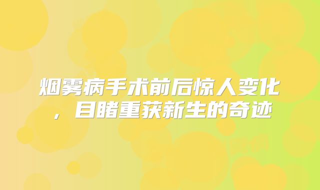 烟雾病手术前后惊人变化，目睹重获新生的奇迹