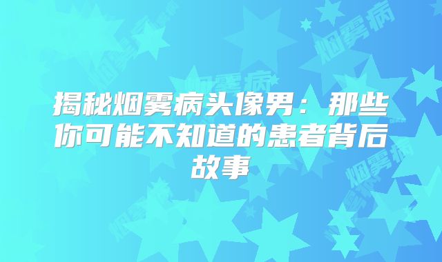 揭秘烟雾病头像男：那些你可能不知道的患者背后故事