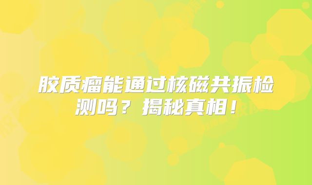 胶质瘤能通过核磁共振检测吗？揭秘真相！