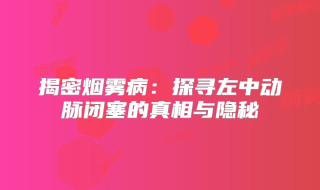 揭密烟雾病：探寻左中动脉闭塞的真相与隐秘