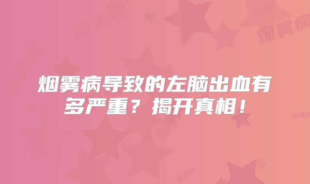 烟雾病导致的左脑出血有多严重？揭开真相！