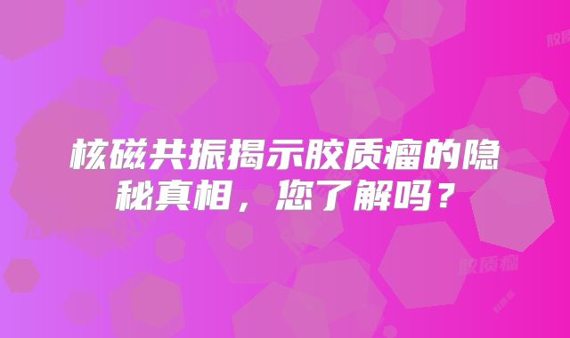 核磁共振揭示胶质瘤的隐秘真相，您了解吗？